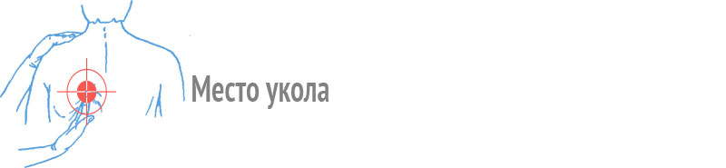 Место укола под лопатку